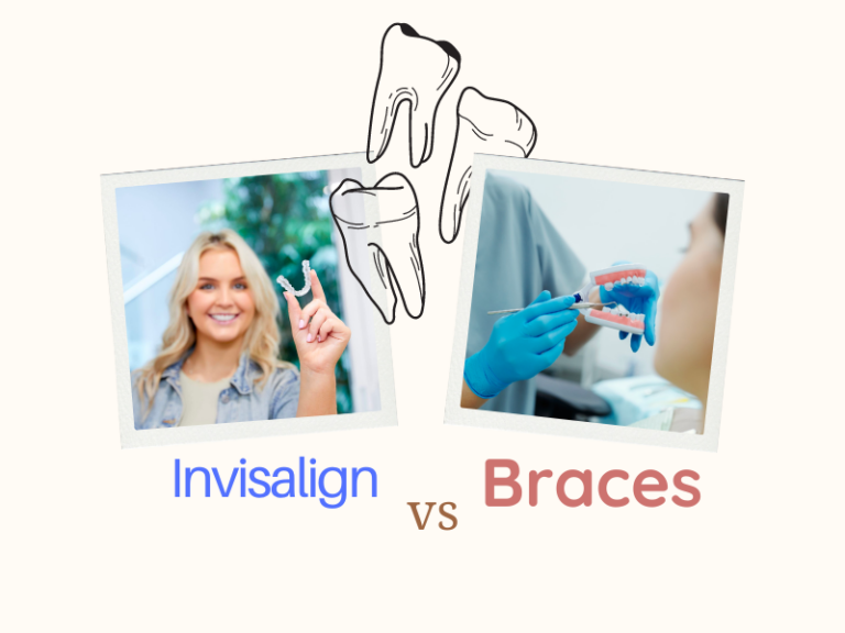 Invisalign Vs Braces Pros Cons To Help You Decide