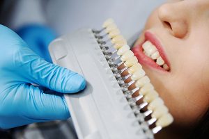 A dentist holding faux coloured teeth next to a woman's teeth